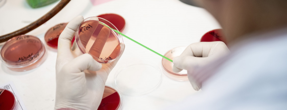 CBH Completes Groundbreaking Study on Rotavirus Epidemic